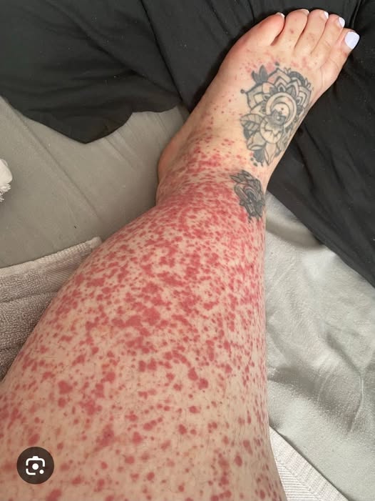 These are the consequences of sleeping in…