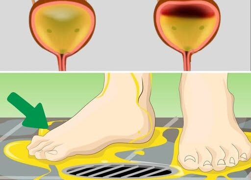 Peeing in the Shower, Doctor Explains Why Women Shouldn’t