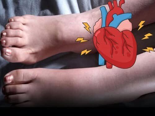6 Foot Symptoms That Could Signal a Heart Attack One Month in Advance
