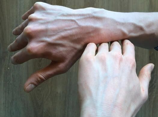 How to Handle Prominent Veins Safely and Responsibly