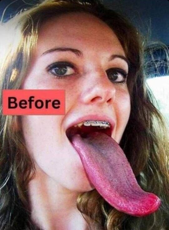 White Tongue Explained: Causes, Care, and Safe Remedies for a Healthy Mouth
