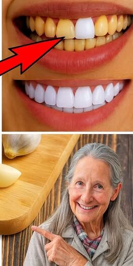 Natural Teeth Whitening with Garlic: Myth or Effective Home Remedy?