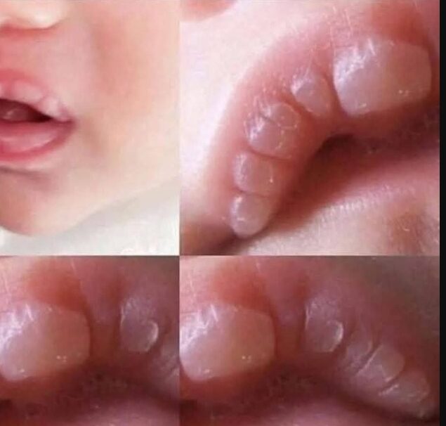 Has these marks it means…