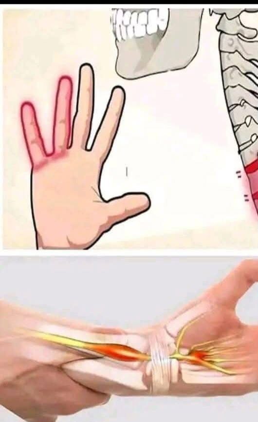 Reasons You Could Have Numbness or Tingling Sensations in Your Hands