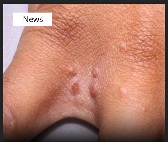 Off The RecordIf You Have These Tiny Red Dots On Your Arm, Do Not Ignore!