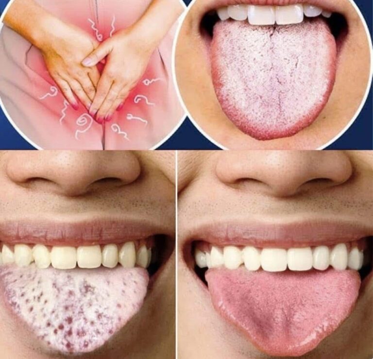 11 Things Your Tongue is Telling You About Your Health