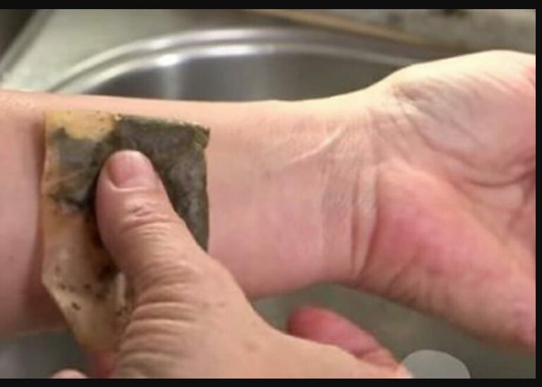 Teabags: 7 household remedies that show why you should never throw away a used teabag again