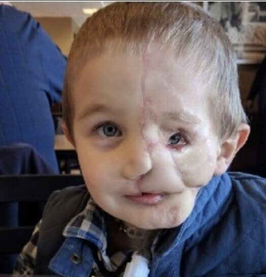 Boy, 5, survives savage attack by two dogs only to be called a ‘monster’ in public