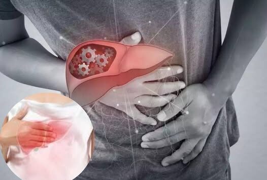 6 Clear Warning Signs Your Liver Is Full Of Toxins & Making You Fat