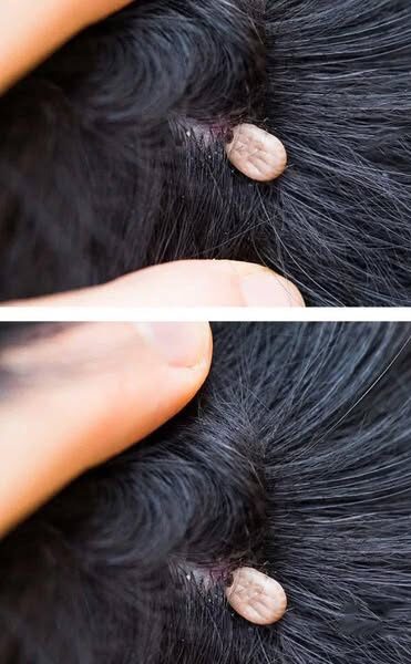 Strange Finding in My Child’s Hair: Should We See a Doctor?