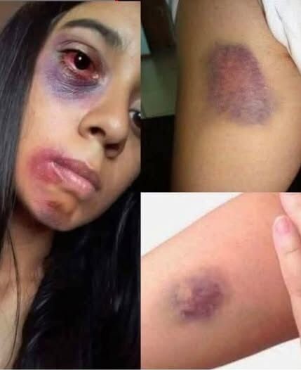 Young woman dies at the hands of her…See more