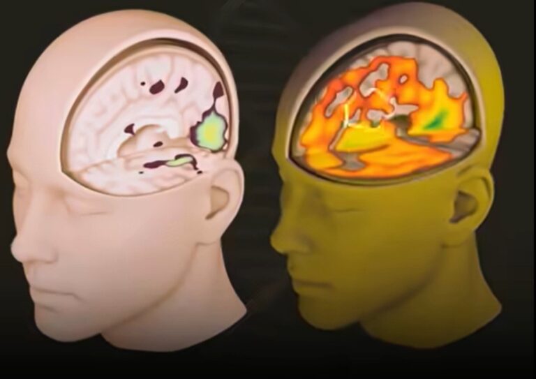 MIT Recently Completed The First Brain-Scan Study On ChatGPT Users—And The Results Are Deeply Concerning
