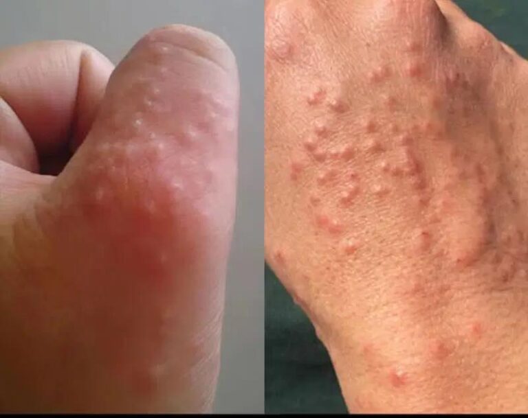 Don’t overlook these small red spots on your arm – They could be important w.arning signs