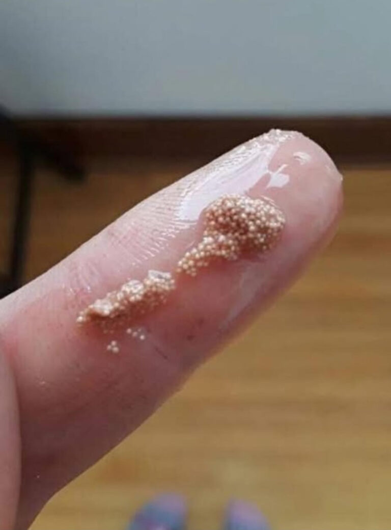 I found slimy lumps in an egg and thought they were insect eggs!