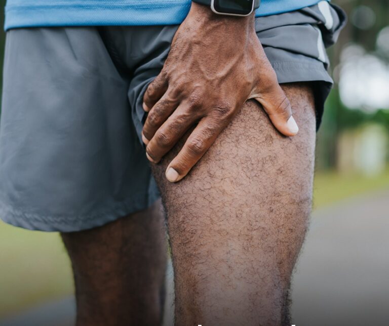 Four symptoms that start in your leg could be a sign of ‘deadly’ cancer