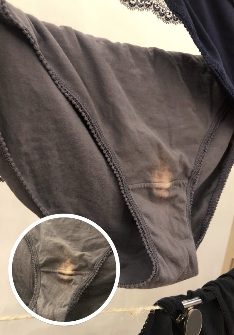 What a ‘Bleach’ Patch Really Means