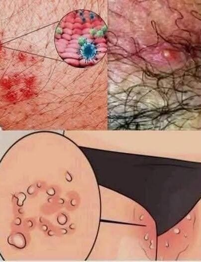 These are the signs that he is cr… See more