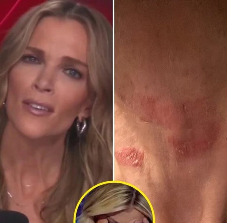 Megyn Kelly Hospitalized in Critical Condition… See more