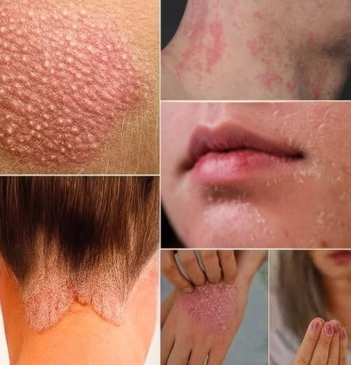 Signs you should know if you have this thing called…