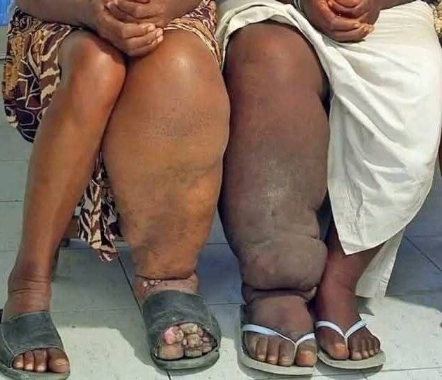 These are the consequences of sleeping with a… See more