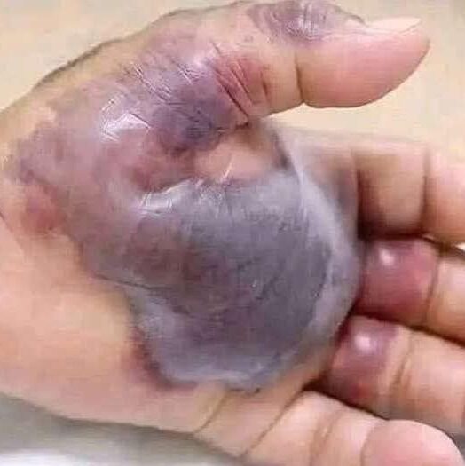 ATTENTION to these first signs of…