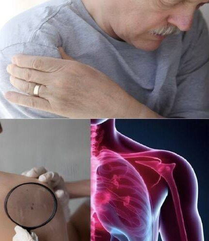 16 Early Signs Cancer Is Growing in Your Body