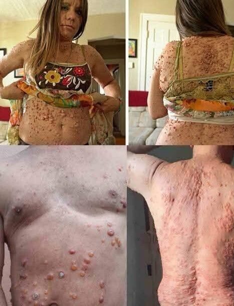 These are the consequences of sleeping with…See more in comment